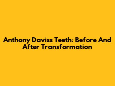 Anthony Davis's Teeth: Before And After Transformation