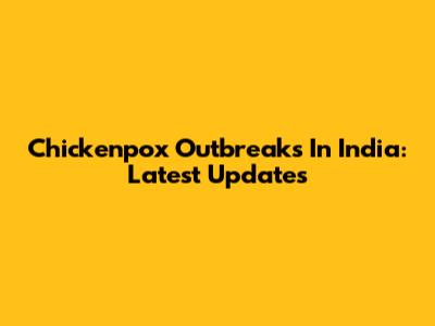 Chickenpox Outbreaks In India: Latest Updates