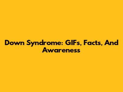 Down Syndrome: GIFs, Facts, And Awareness