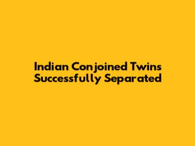 Indian Conjoined Twins Successfully Separated