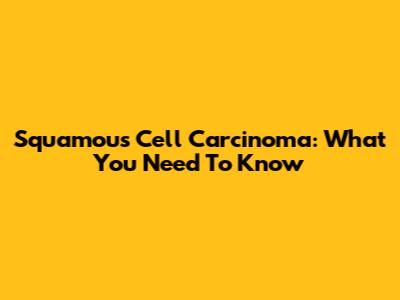Squamous Cell Carcinoma: What You Need To Know