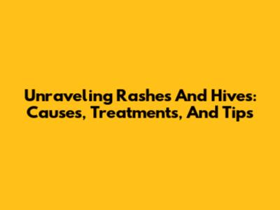 Unraveling Rashes And Hives: Causes, Treatments, And Tips